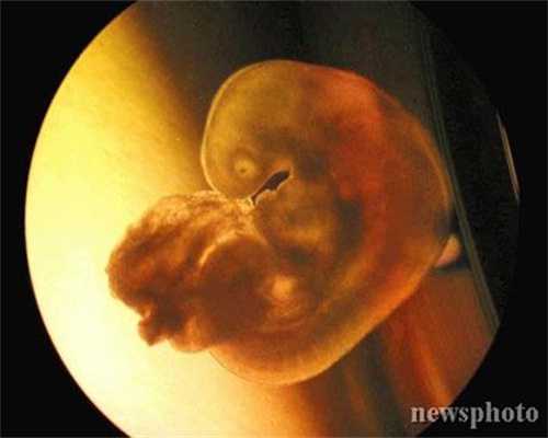 单身人士到代孕_寻找代孕母亲_输卵管积水艾灸部位图4