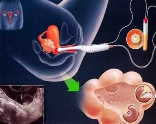 代孕的女人哪里找_代孕合同是否有效_女人输卵管堵塞是什么原因造成的5