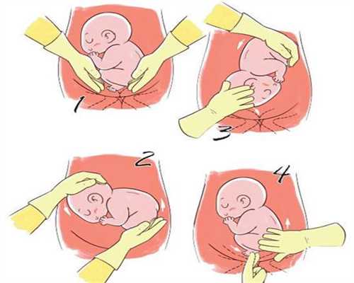代孕生宝宝_哪家三甲医院可以做代孕_让精子飞？怎样才能怀孕？