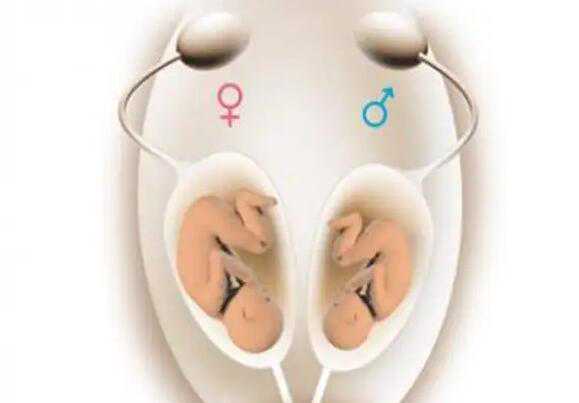 试管婴儿取卵代孕_代孕不孕不育_第三代泰国试管婴儿能选性别吗？可以选择男