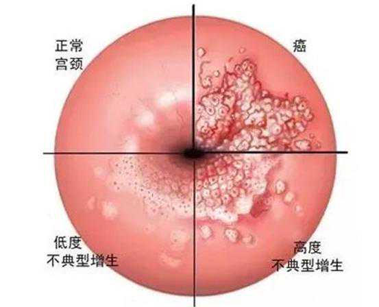天津招聘助孕机构 天津哪家医院有试管婴儿资质? ‘b超形状看男女’
