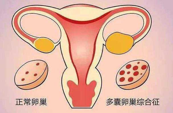 哪个国家代孕最多_哪里有代孕生孩子的_【湘雅医院可以做供卵试管吗】氏筛查